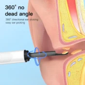 Ear Cleaner with Camera Ear Sticks Otoscope USB Type-C Andrid Charging Endoscope Wax Removal Tool Earpick Camera Health Care 4
